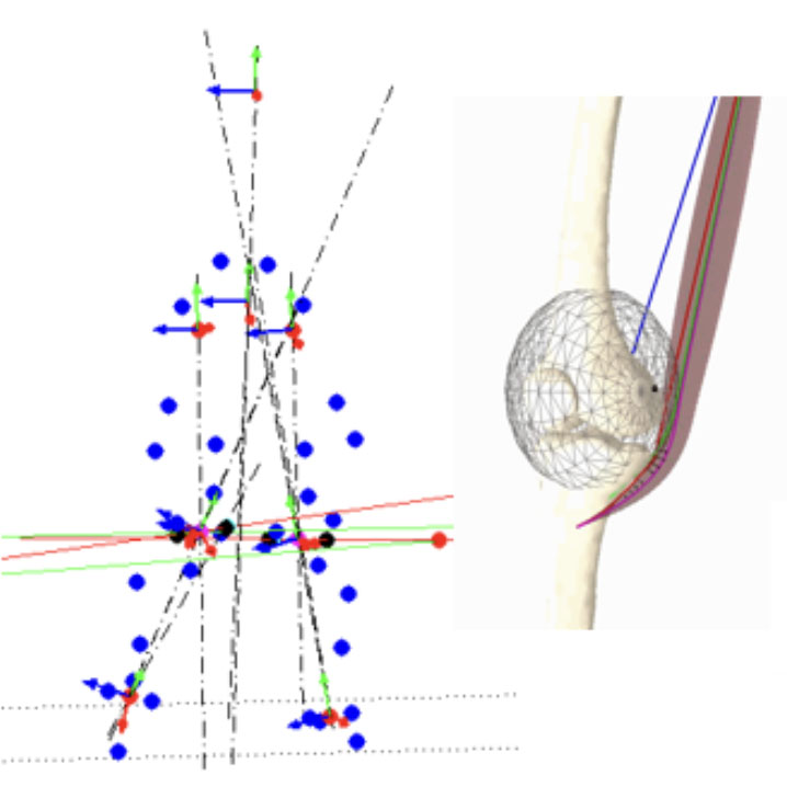 Représentions de l'Unité d’Analyse du Mouvement : Analyse du mouvement, développement de modèles biomécaniques et analyse des effets de la Chirurgie Multi-étagée